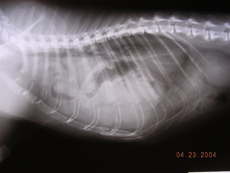 diaphragmatic hernia mcmichael sized